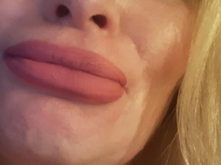 Foto